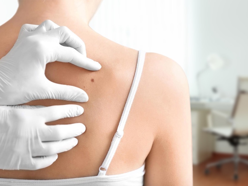 Kožní ambulance - MUDr. Jan Kilian